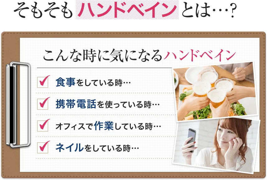 そもそもハンドベインとは…？