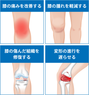 PRP-FD(PFC-FD)療法の効果
