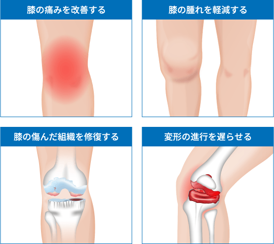 PRP-FD(PFC-FD)療法の効果