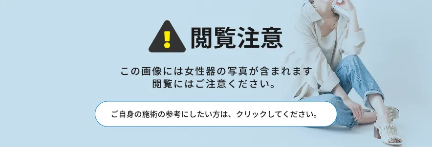 閲覧注意