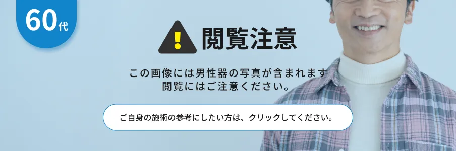 閲覧注意