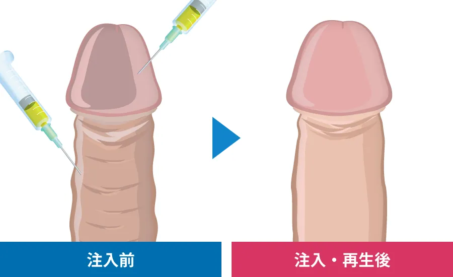 見た目の若返り効果