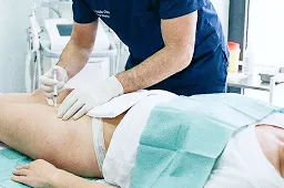 尿道括約筋や尿道粘膜へPRPを注入する施術